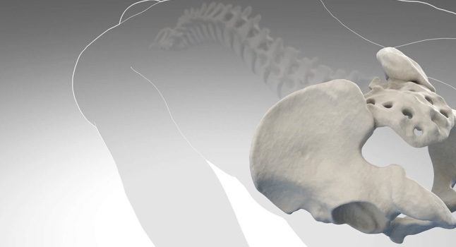Video - SI Joint Surgery Animation