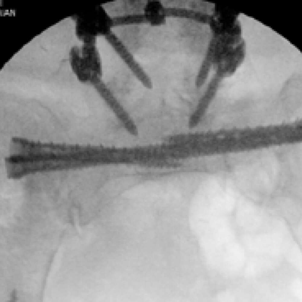 Brian Cunningham MD
