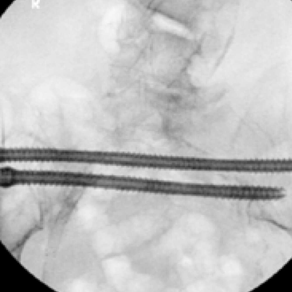 Brian Cunningham MD