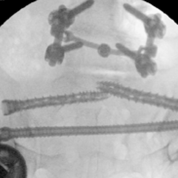 Brian Cunningham MD