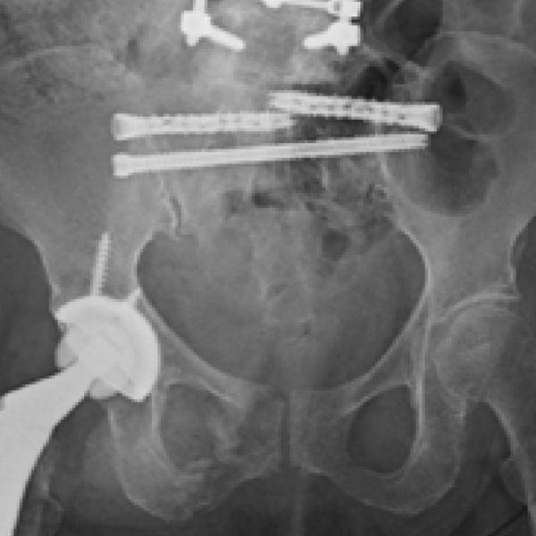 Brian Cunningham MD