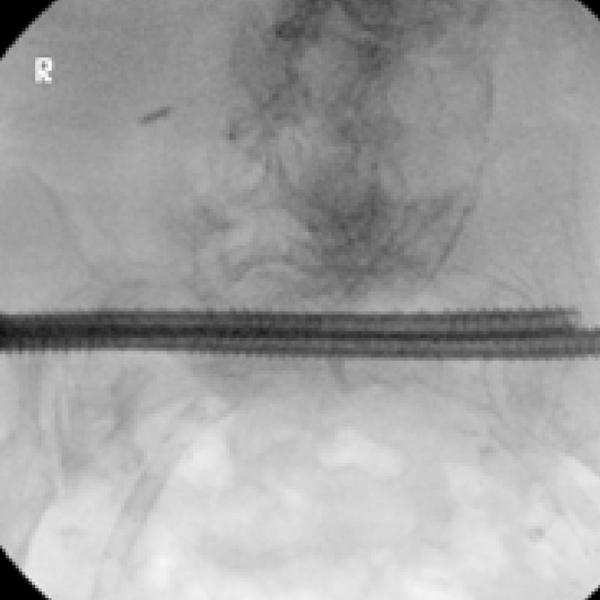 Brian Cunningham MD