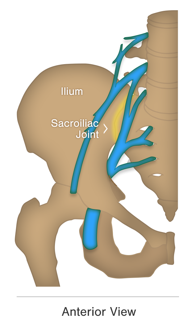 Sciatica VS Sciatic Pain